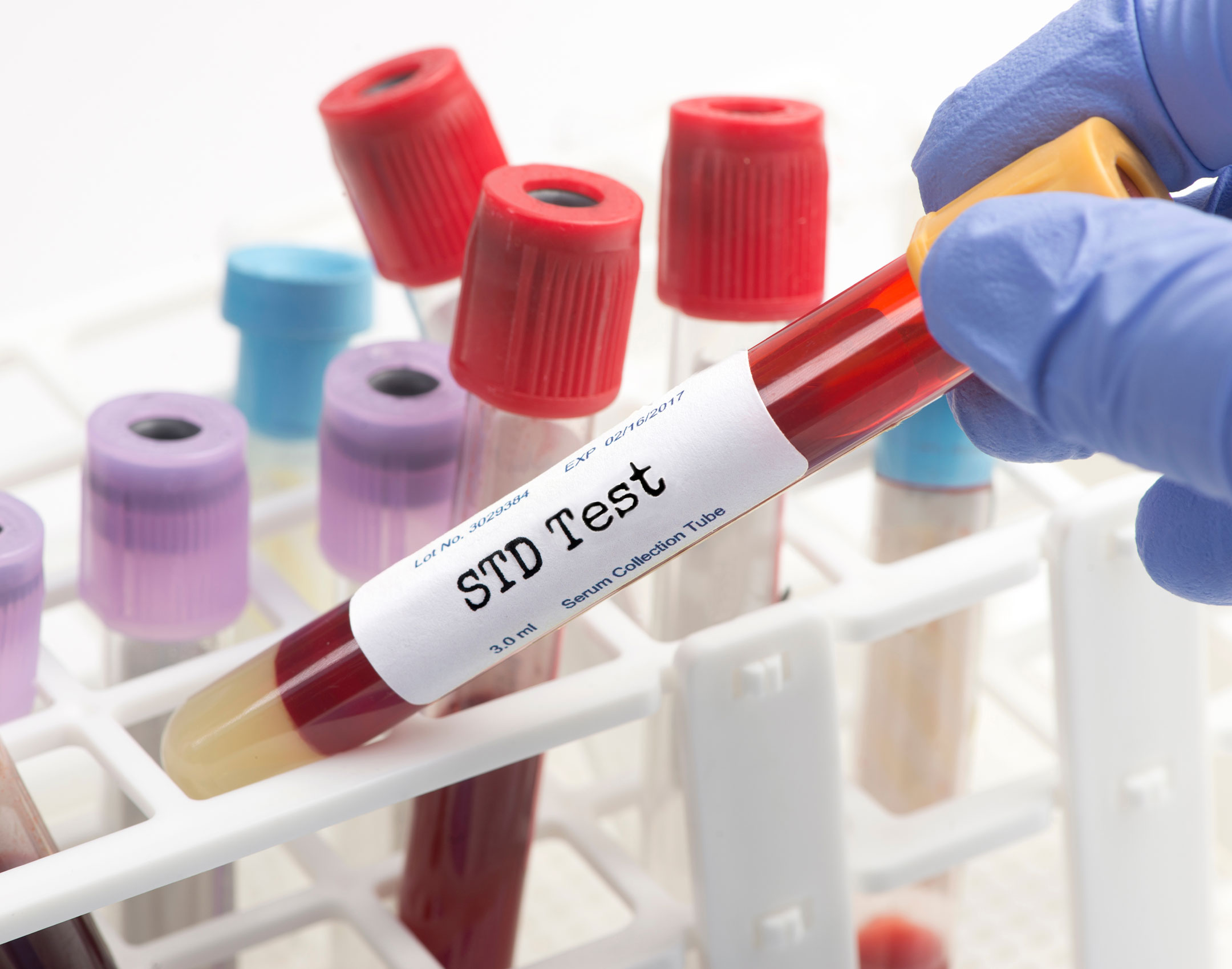 STD Test Vial