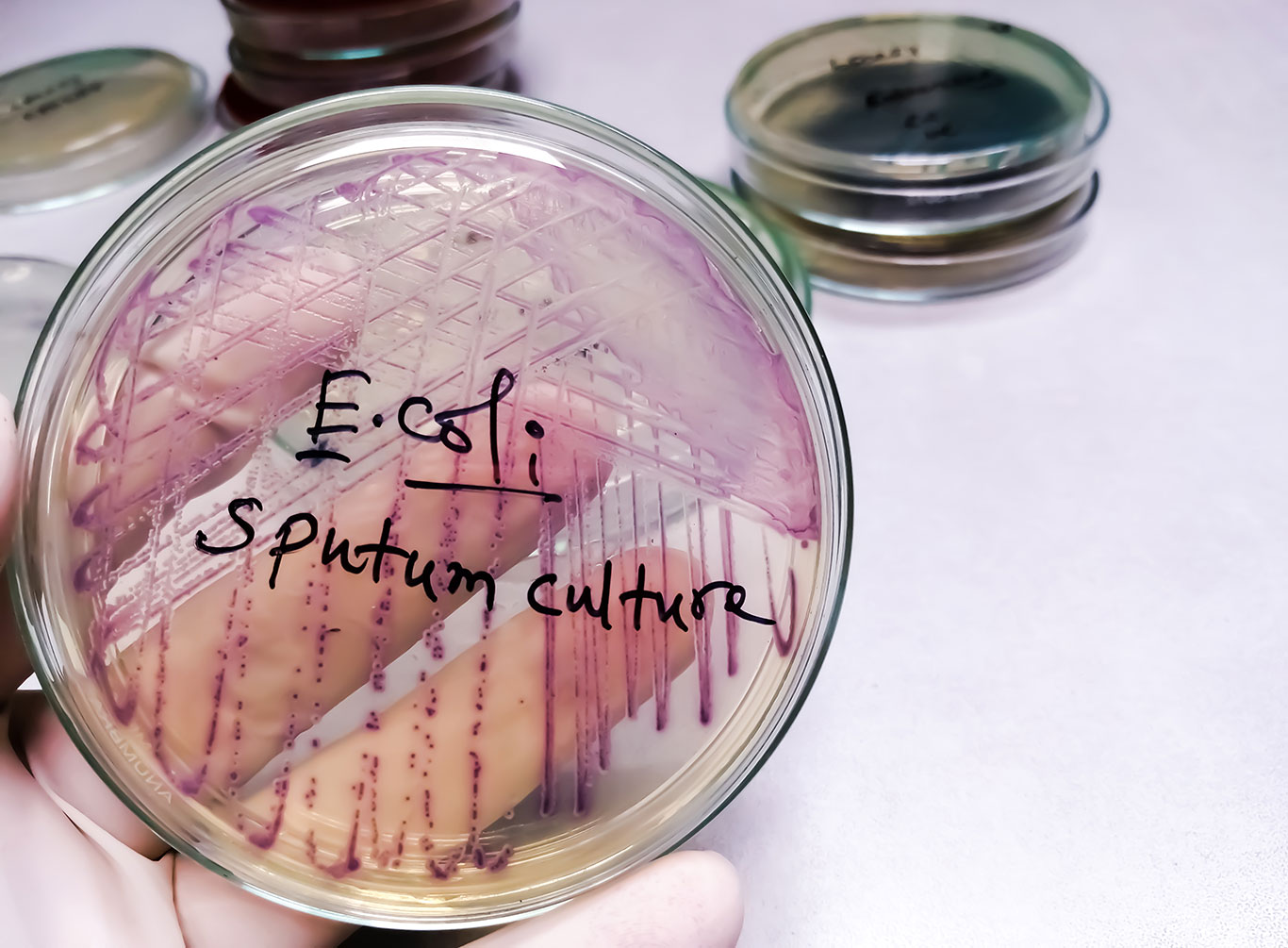E.Coli Specimen