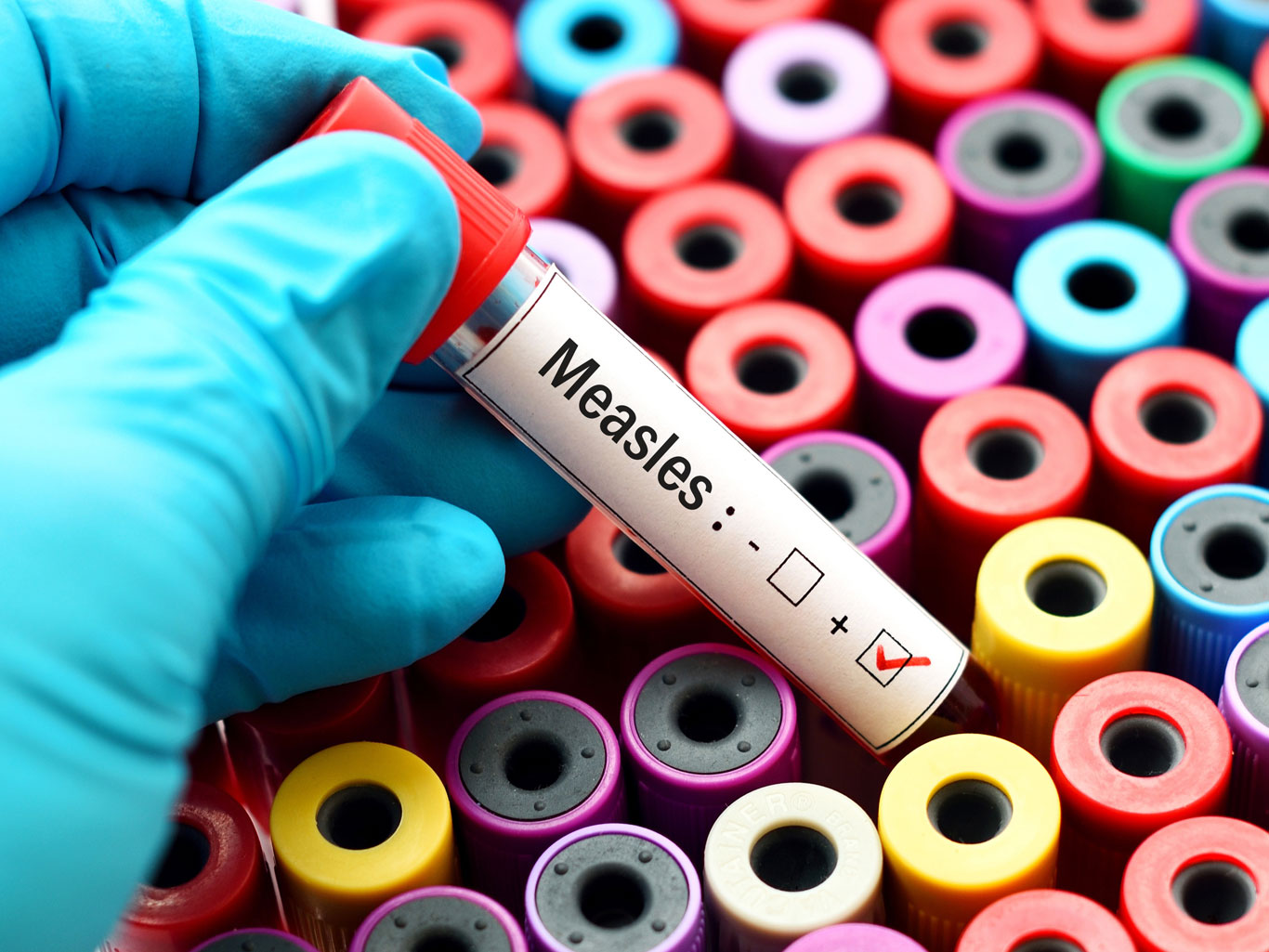 Measles under a mircoscope